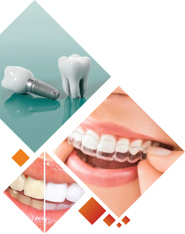 Finedent dental clinics