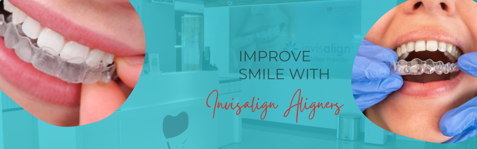 Invisalign Aligners Finedent dental clinics