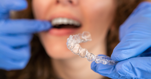 Invisalign Treatment 