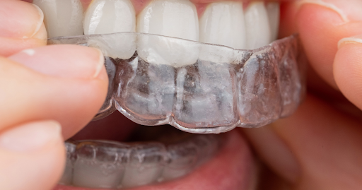 Invisalign braces