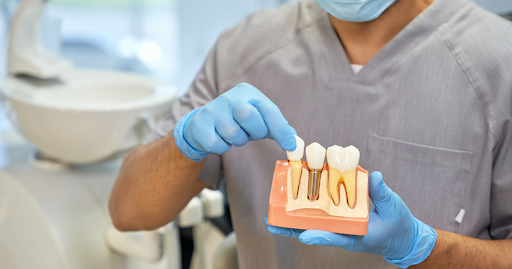 Dental Implant
