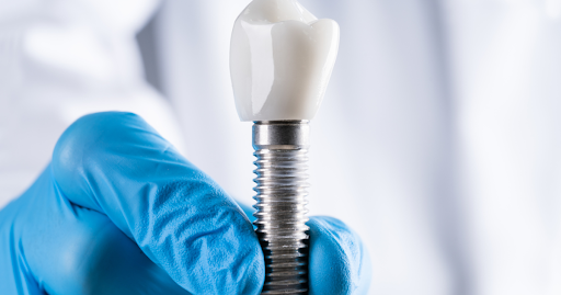 Dental implant