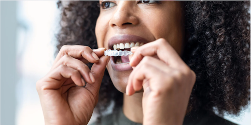 Invisalign Braces in Hyderabad 