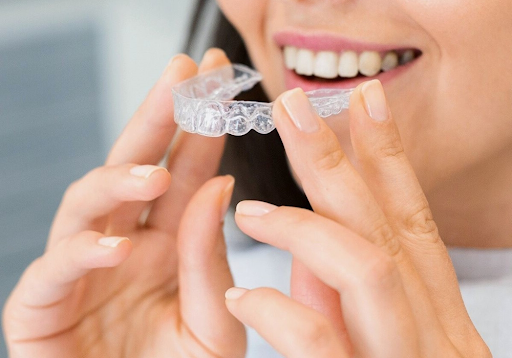  Invisalign Clear Aligners in hyderabad