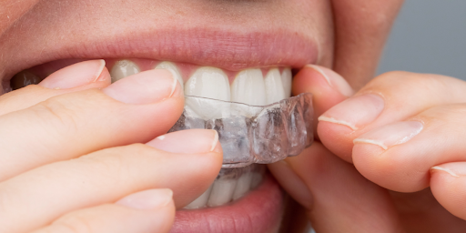 Best Orthodontist in Hyderabad
