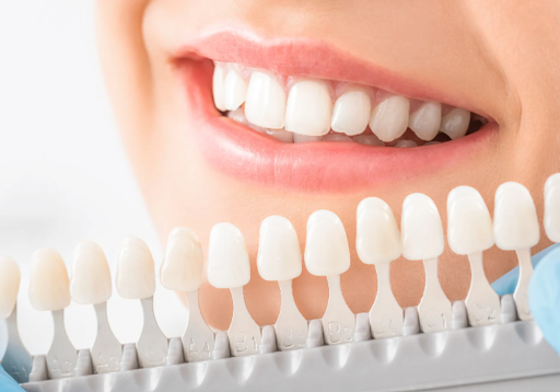 best dental clinic in Hyderabad
