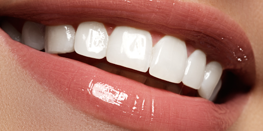 dental clinics in Hyderabad
