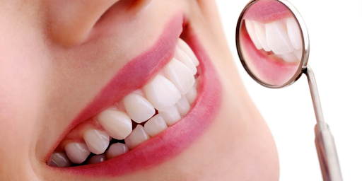 Clear Aligners in Nallagandla