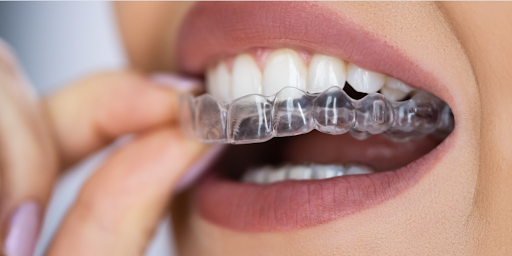 Invisalign Clinic in Hyderabad