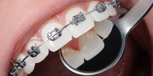 Orthodontist in Hyderabad