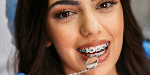 Top Dental Braces Specialist Hyderabad 