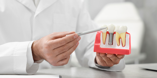 Dental Clinic in Nallagandla