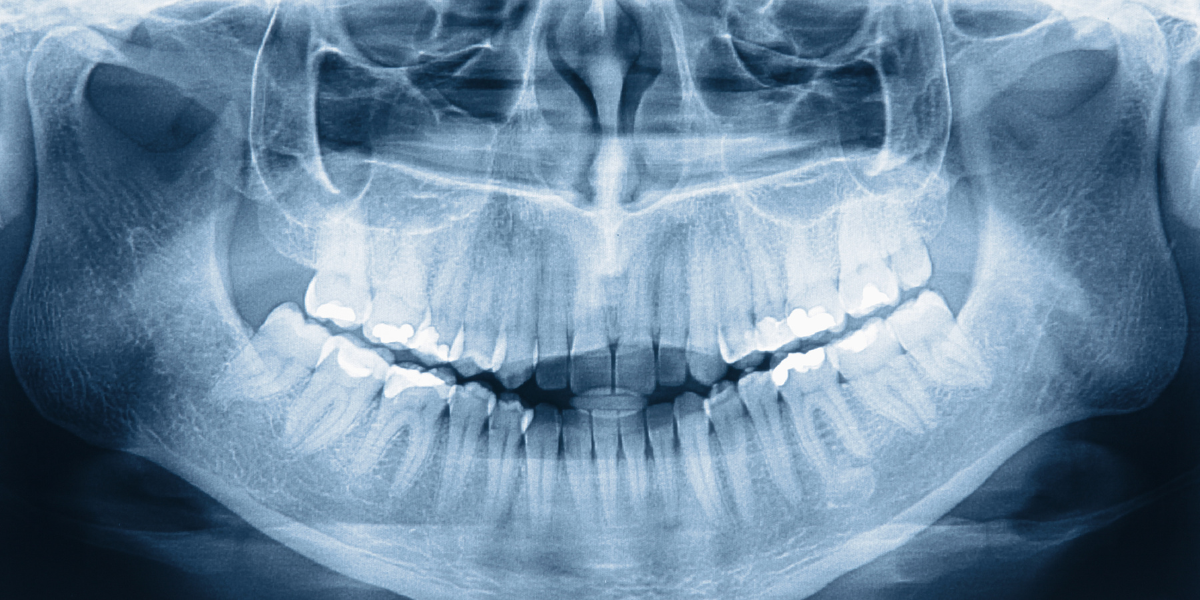  AI dental diagnosis 