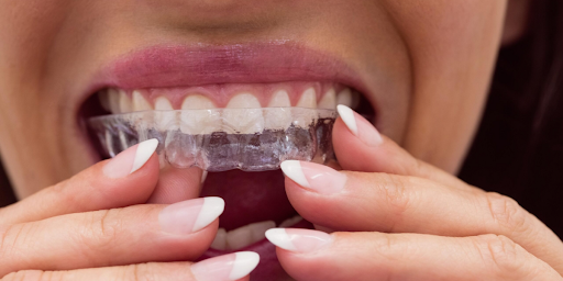 Artificial intelligence in orthodontics