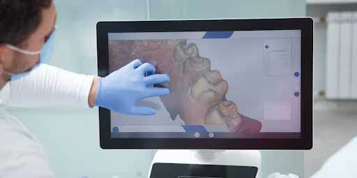 Role of AI at Finedent Dental Clinics