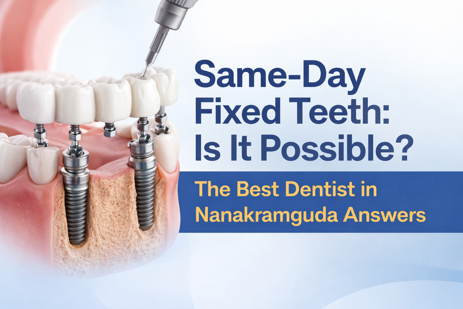 Fixed Teeth