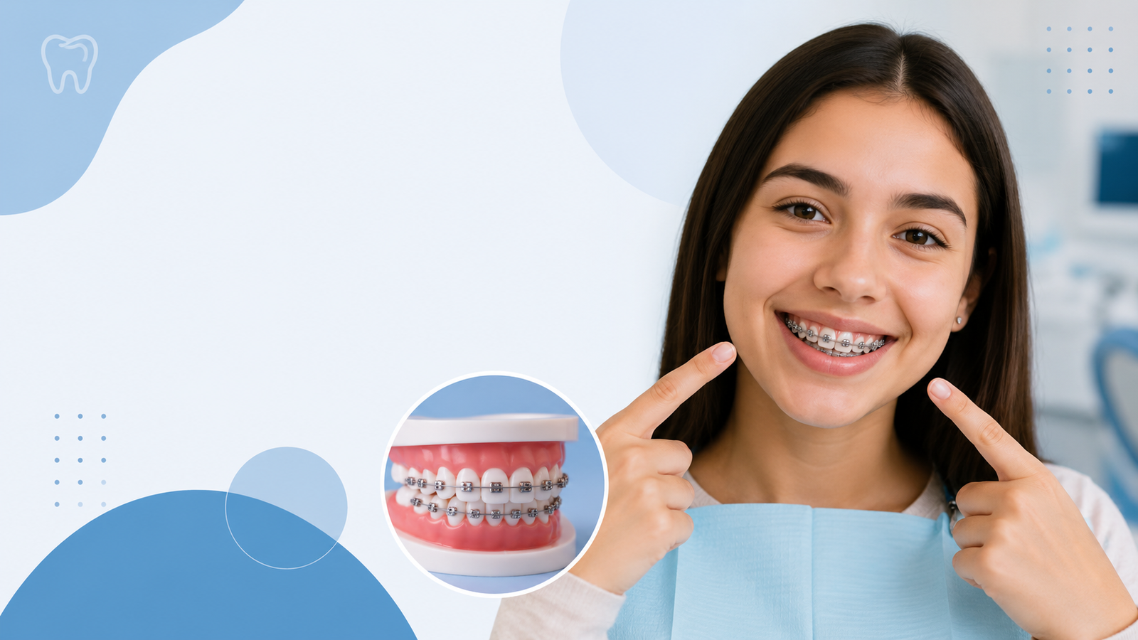  Braces Treatment